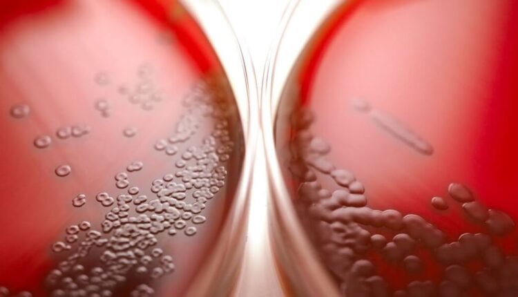 Δεν-υπάρχει-επιδημία-στρεπτόκοκκου-βεβαιώνει-ο-Πανελλήνιος-Ιατρικός-Σύλλογος