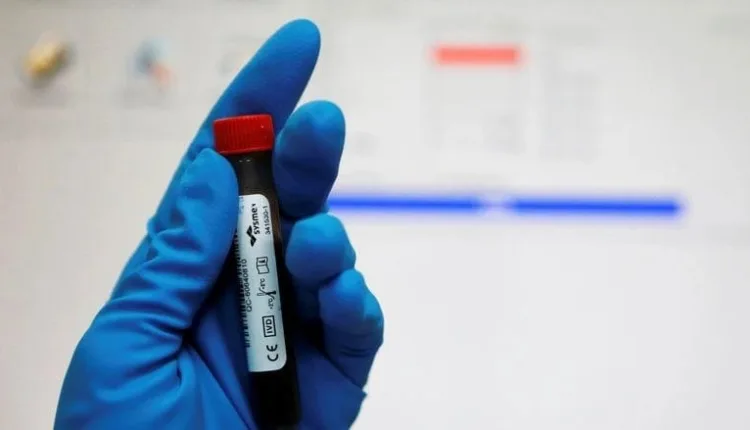 Παγκόσμιος-Οργανισμός-Αντιντόπινγκ:-Οι-ΗΠΑ-επιτρέπουν-σε-ντοπαρισμένους-αθλητές-να-αγωνίζονται