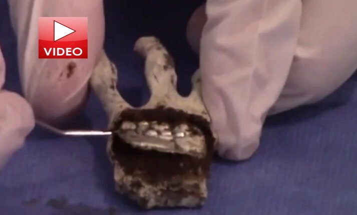 Ανατριχιαστικό-βίντεο-από-την-ανατομία-στις-«εξωγήινες-μούμιες»-που-βρέθηκαν-στο-Περού