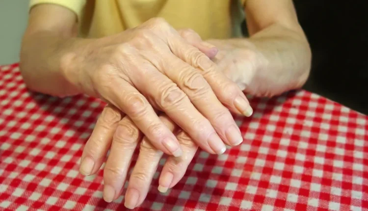 Υγεία:-Ρευματοειδής-αρθρίτιδα-–-Τροφές-που-αυξάνουν-και-μειώνουν-τον-κίνδυνο