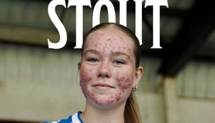 Ποδόσφαιρο-Γυναικών:-Με-γκολ-ποίημα-στο-ντεμπούτο-της-απάντησε-στο-bullying-η-16χρονη-Σκάι-Στάουτ