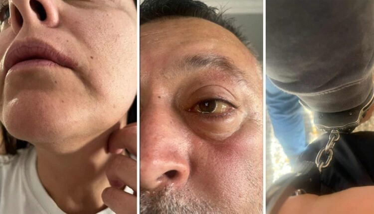 Έβαλαν-χειροπέδες-και-κακοποίησαν-ζευγάρι-Τούρκων-τουριστών